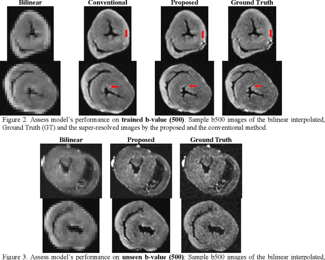Figure 4 for High-Resolution Reference Image Assisted Volumetric Super-Resolution of Cardiac Diffusion Weighted Imaging