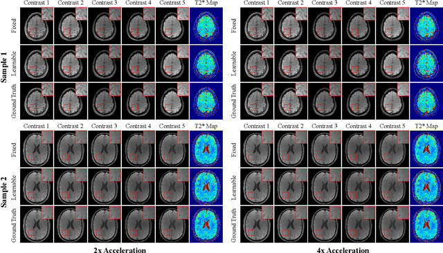 Figure 4 for JoJoNet: Joint-contrast and Joint-sampling-and-reconstruction Network for Multi-contrast MRI