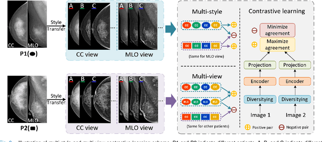 Figure 3 for Domain Generalization for Mammographic Image Analysis via Contrastive Learning
