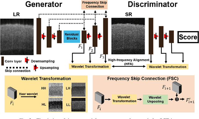Figure 2 for Frequency-aware optical coherence tomography image super-resolution via conditional generative adversarial neural network