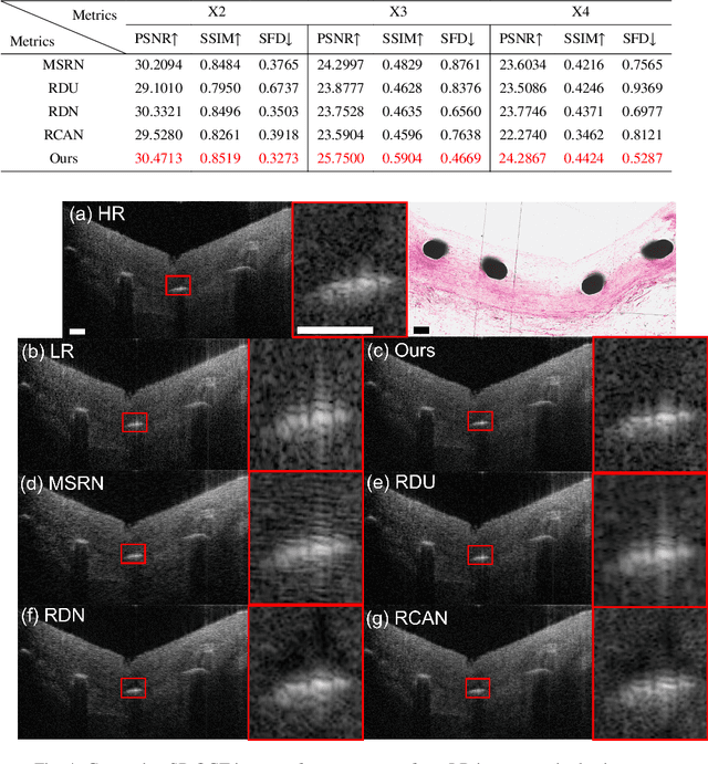 Figure 4 for Frequency-aware optical coherence tomography image super-resolution via conditional generative adversarial neural network