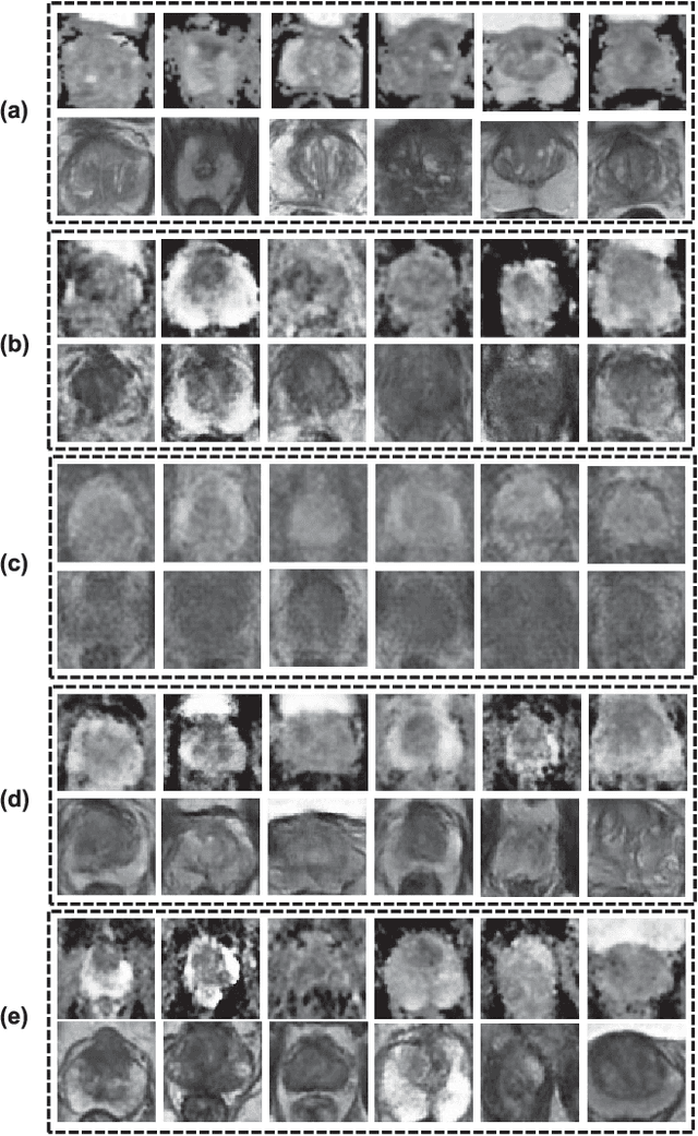 Figure 1 for Bi-Modality Medical Image Synthesis Using Semi-Supervised Sequential Generative Adversarial Networks