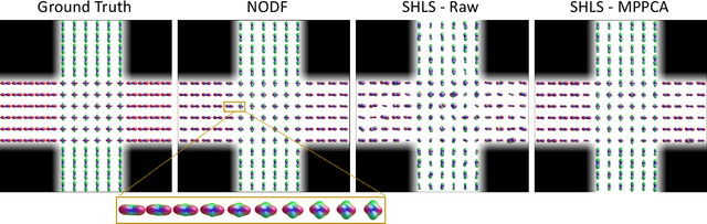 Figure 3 for Neural Orientation Distribution Fields for Estimation and Uncertainty Quantification in Diffusion MRI