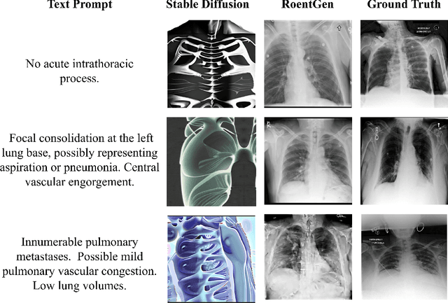 Figure 3 for Utilizing Synthetic Data for Medical Vision-Language Pre-training: Bypassing the Need for Real Images