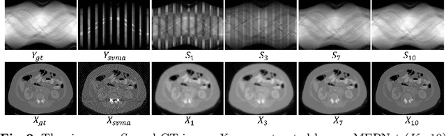 Figure 3 for MEPNet: A Model-Driven Equivariant Proximal Network for Joint Sparse-View Reconstruction and Metal Artifact Reduction in CT Images