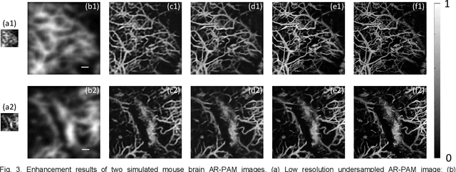 Figure 3 for HSD-PAM: High Speed Super Resolution Deep Penetration Photoacoustic Microscopy Imaging Boosted by Dual Branch Fusion Network