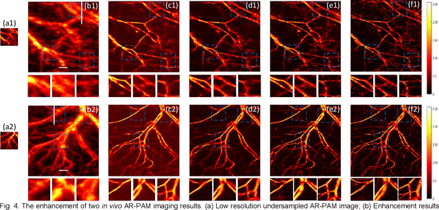 Figure 4 for HSD-PAM: High Speed Super Resolution Deep Penetration Photoacoustic Microscopy Imaging Boosted by Dual Branch Fusion Network