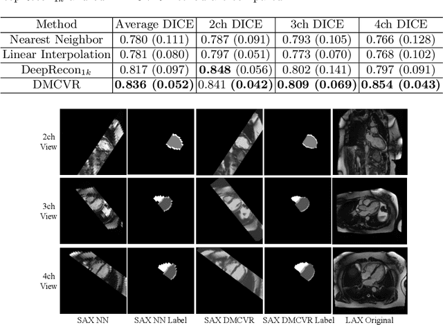 Figure 4 for DMCVR: Morphology-Guided Diffusion Model for 3D Cardiac Volume Reconstruction