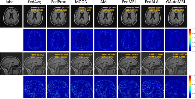 Figure 4 for Generalizable Learning Reconstruction for Accelerating MR Imaging via Federated Neural Architecture Search