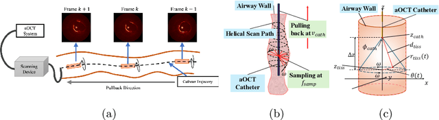 Figure 1 for NeuralOCT: Airway OCT Analysis via Neural Fields