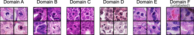 Figure 1 for Domain generalization across tumor types, laboratories, and species -- insights from the 2022 edition of the Mitosis Domain Generalization Challenge