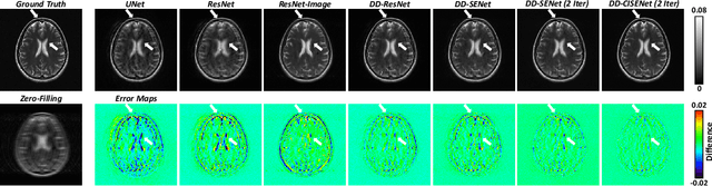 Figure 3 for DD-CISENet: Dual-Domain Cross-Iteration Squeeze and Excitation Network for Accelerated MRI Reconstruction