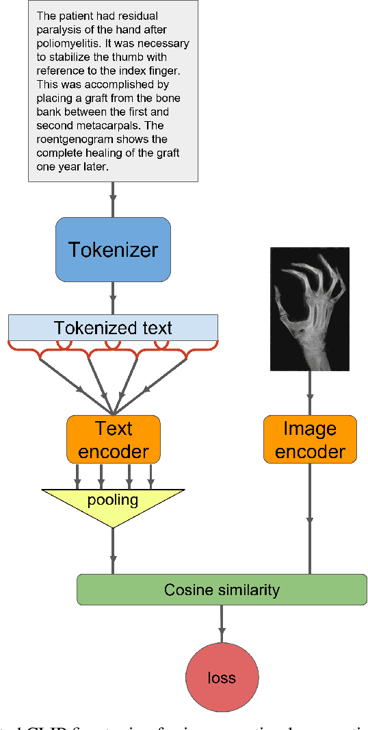 Figure 1 for Increasing Textual Context Size Boosts Medical Image-Text Matching