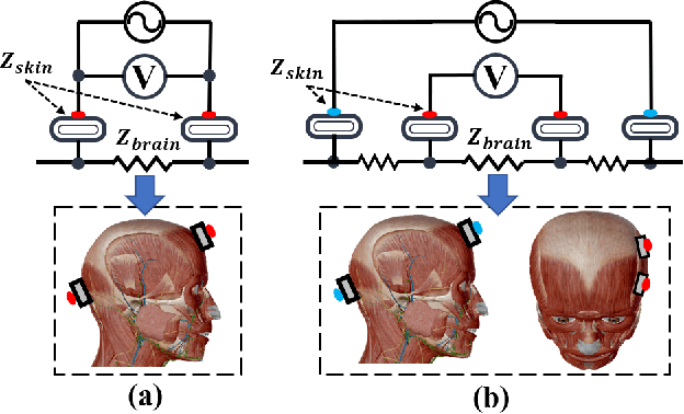 Figure 1 for BrainZ-BP: A Non-invasive Cuff-less Blood Pressure Estimation Approach Leveraging Brain Bio-impedance and Electrocardiogram
