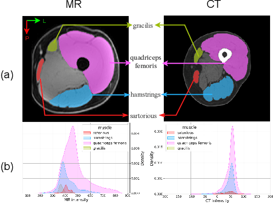Figure 1 for Single Slice Thigh CT Muscle Group Segmentation with Domain Adaptation and Self-Training