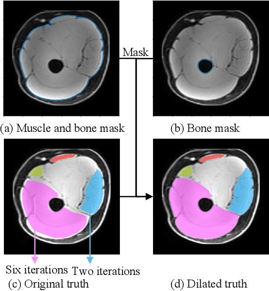 Figure 2 for Single Slice Thigh CT Muscle Group Segmentation with Domain Adaptation and Self-Training