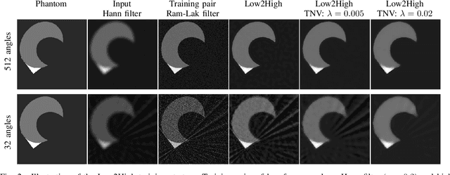 Figure 3 for Unsupervised denoising for sparse multi-spectral computed tomography