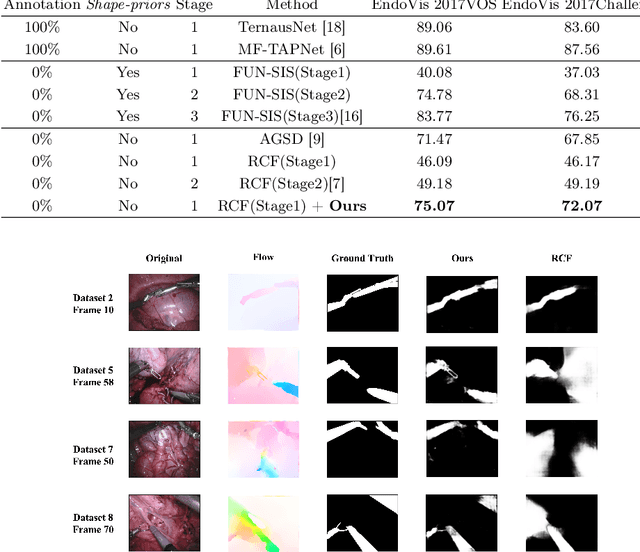 Figure 4 for Rethinking Low-quality Optical Flow in Unsupervised Surgical Instrument Segmentation