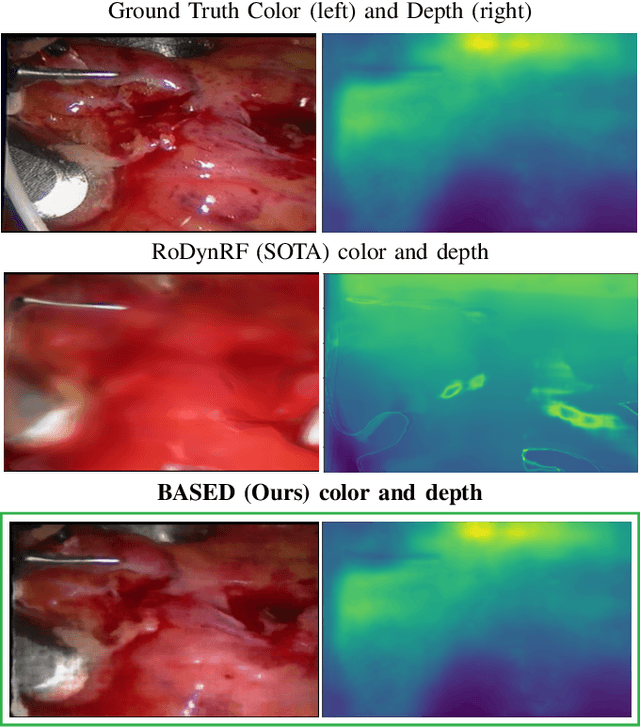 Figure 1 for BASED: Bundle-Adjusting Surgical Endoscopic Dynamic Video Reconstruction using Neural Radiance Fields