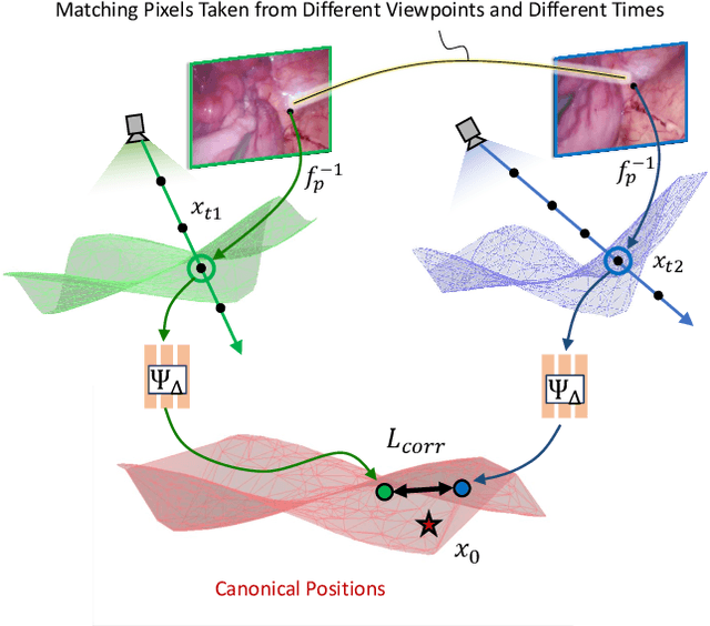 Figure 3 for BASED: Bundle-Adjusting Surgical Endoscopic Dynamic Video Reconstruction using Neural Radiance Fields