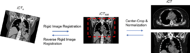 Figure 1 for Deep-Learning-based Fast and Accurate 3D CT Deformable Image Registration in Lung Cancer