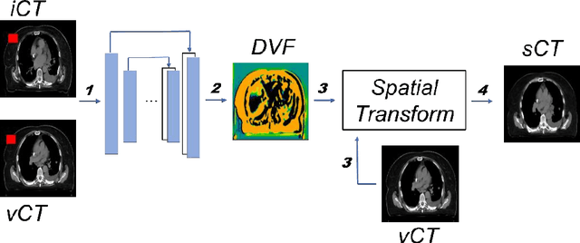 Figure 3 for Deep-Learning-based Fast and Accurate 3D CT Deformable Image Registration in Lung Cancer
