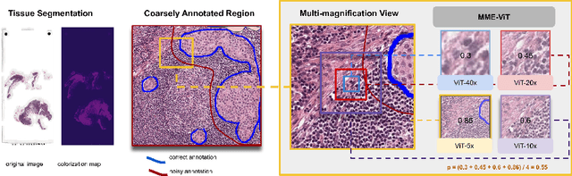 Figure 1 for Robust Tumor Detection from Coarse Annotations via Multi-Magnification Ensembles