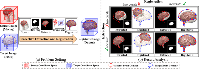 Figure 1 for ERNet: Unsupervised Collective Extraction and Registration in Neuroimaging Data