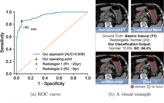 Figure 3 for Cluster-Induced Mask Transformers for Effective Opportunistic Gastric Cancer Screening on Non-contrast CT Scans