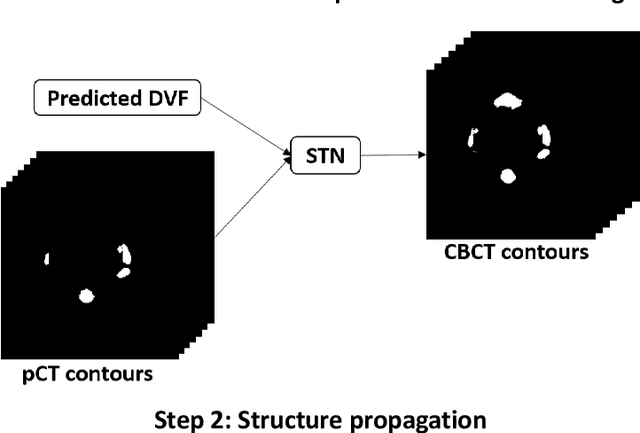 Figure 1 for Segmentation by Test-Time Optimization (TTO) for CBCT-based Adaptive Radiation Therapy
