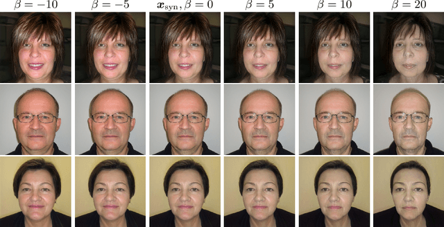 Figure 4 for Deep Learning for Cancer Prognosis Prediction Using Portrait Photos by StyleGAN Embedding