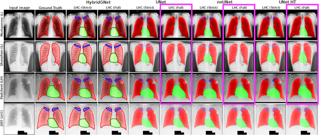 Figure 1 for Multi-center anatomical segmentation with heterogeneous labels via landmark-based models