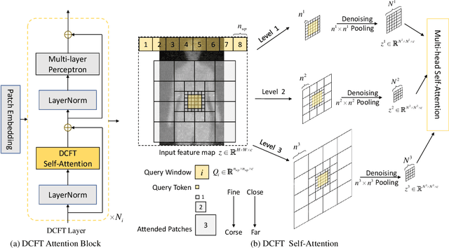 Figure 3 for Concealed Object Detection for Passive Millimeter-Wave Security Imaging Based on Task-Aligned Detection Transformer