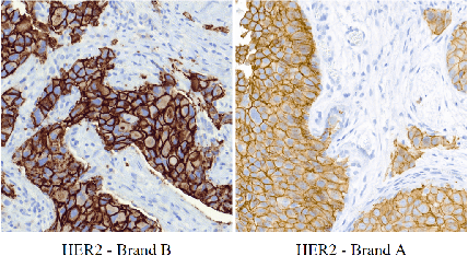 Figure 1 for Color Deconvolution applied to Domain Adaptation in HER2 histopathological images