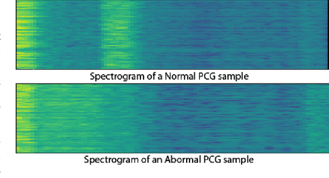 Figure 2 for SpectNet : End-to-End Audio Signal Classification Using Learnable Spectrograms