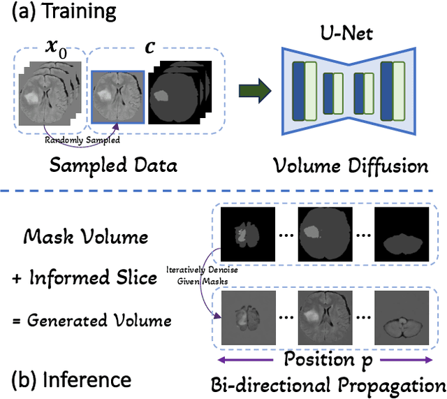 Figure 1 for Generative Enhancement for 3D Medical Images