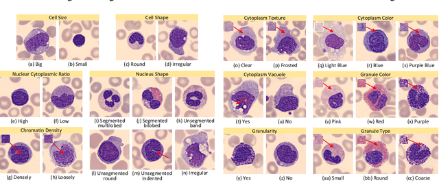 Figure 2 for WBCAtt: A White Blood Cell Dataset Annotated with Detailed Morphological Attributes