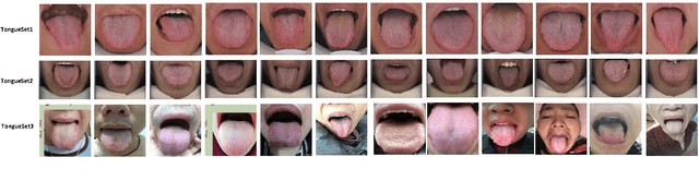 Figure 3 for TongueSAM: An Universal Tongue Segmentation Model Based on SAM with Zero-Shot