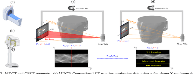 Figure 2 for Nonlinear ill-posed problem in low-dose dental cone-beam computed tomography