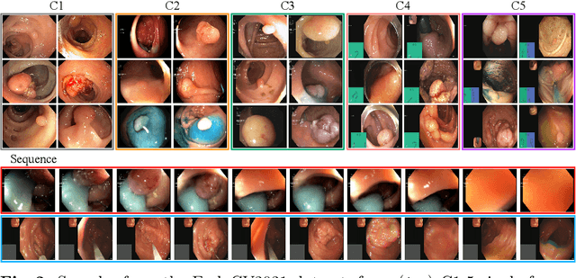 Figure 3 for Bayesian uncertainty-weighted loss for improved generalisability on polyp segmentation task