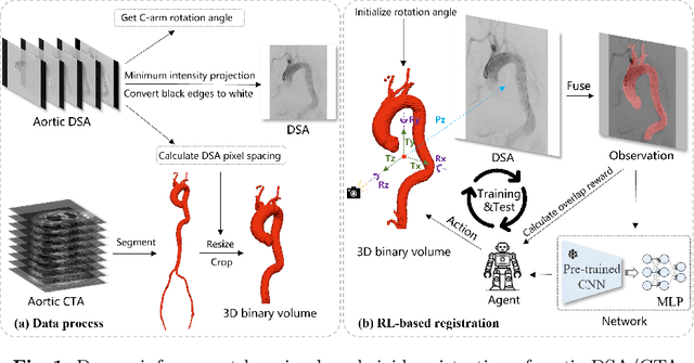 Figure 1 for UDCR: Unsupervised Aortic DSA/CTA Rigid Registration Using Deep Reinforcement Learning and Overlap Degree Calculation