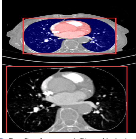 Figure 2 for Anatomically aware dual-hop learning for pulmonary embolism detection in CT pulmonary angiograms