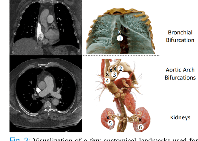 Figure 3 for Anatomically aware dual-hop learning for pulmonary embolism detection in CT pulmonary angiograms