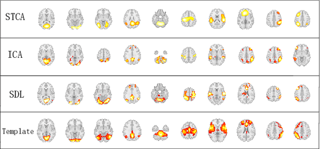 Figure 4 for Spatial-Temporal Convolutional Attention for Mapping Functional Brain Networks
