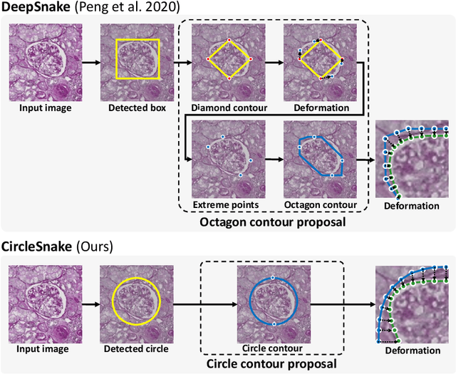 Figure 3 for CircleSnake: Instance Segmentation with Circle Representation
