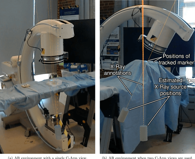 Figure 4 for On-the-fly Augmented Reality for Orthopaedic Surgery Using a Multi-Modal Fiducial