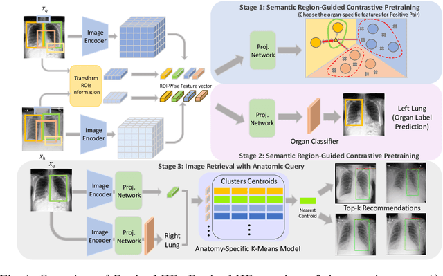 Figure 1 for Region-based Contrastive Pretraining for Medical Image Retrieval with Anatomic Query