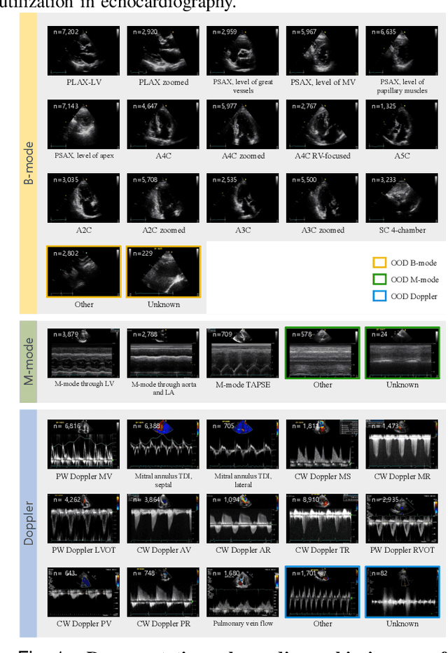 Figure 1 for Echocardiographic View Classification with Integrated Out-of-Distribution Detection for Enhanced Automatic Echocardiographic Analysis