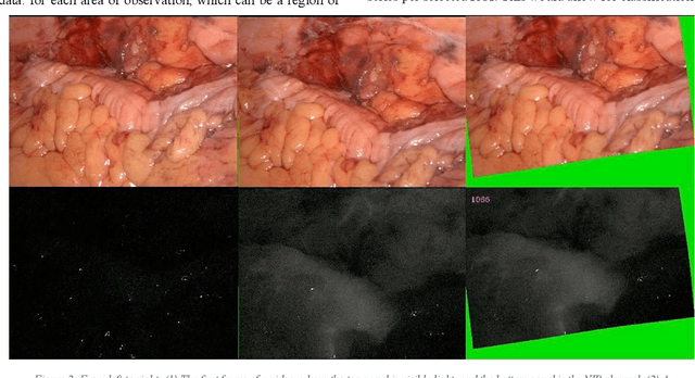 Figure 1 for Extracting, Visualizing, and Learning from Dynamic Data: Perfusion in Surgical Video for Tissue Characterization