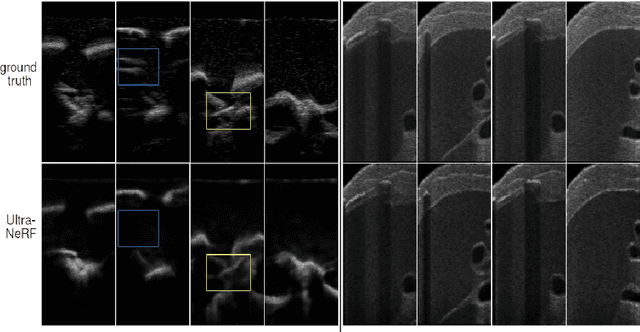 Figure 4 for Ultra-NeRF: Neural Radiance Fields for Ultrasound Imaging